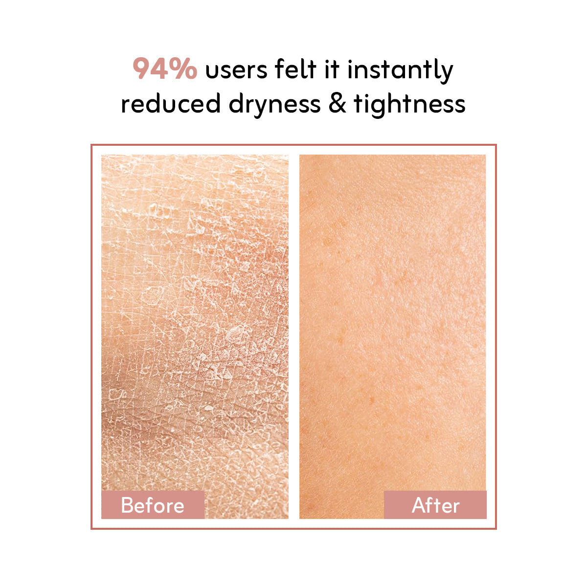 HydraBoost Face Serum For Deep Skin Hydration 30ml