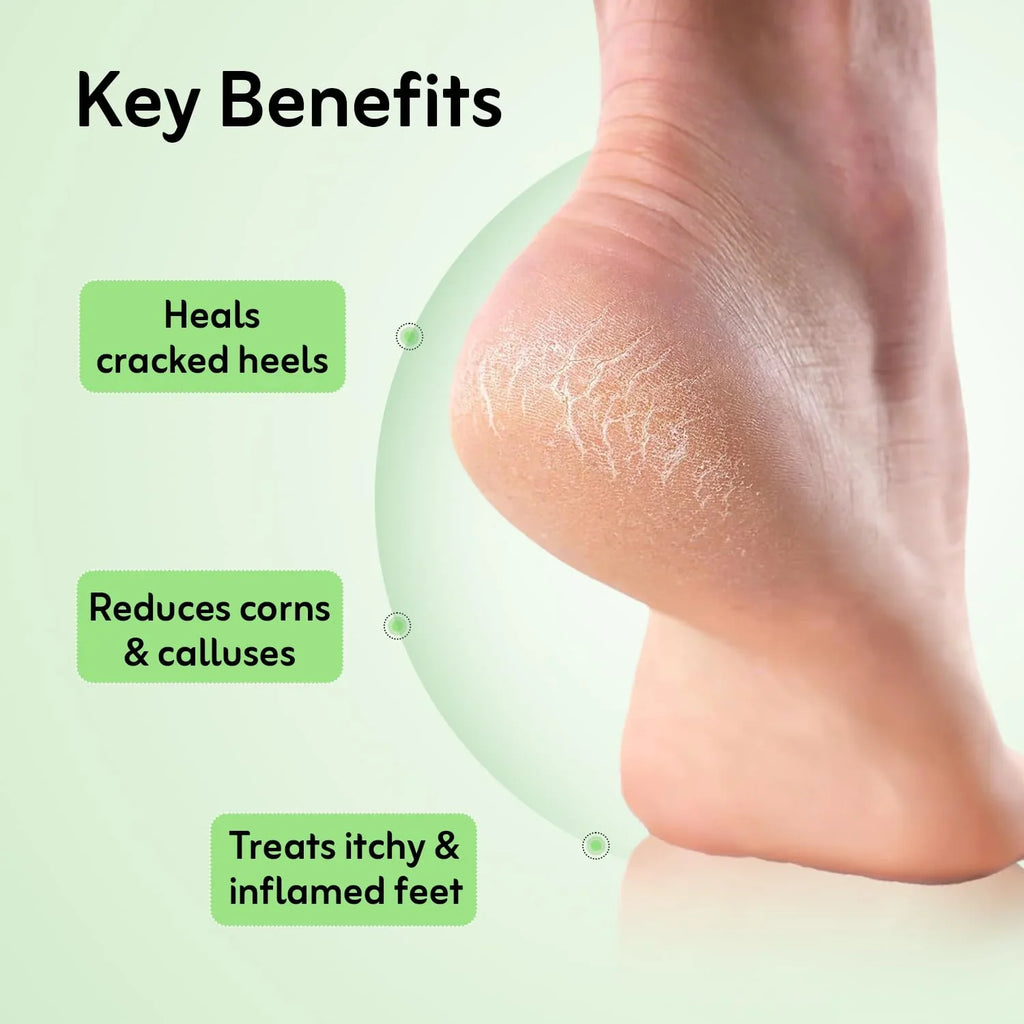 Crack Heel Repair Cream 25gm Ayurvedic Foot care cream