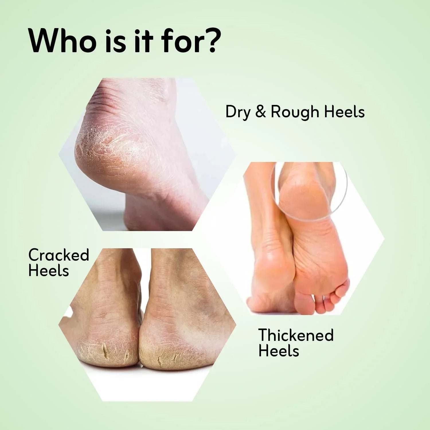 Crack Heel Repair Cream 25gm Ayurvedic Foot care cream