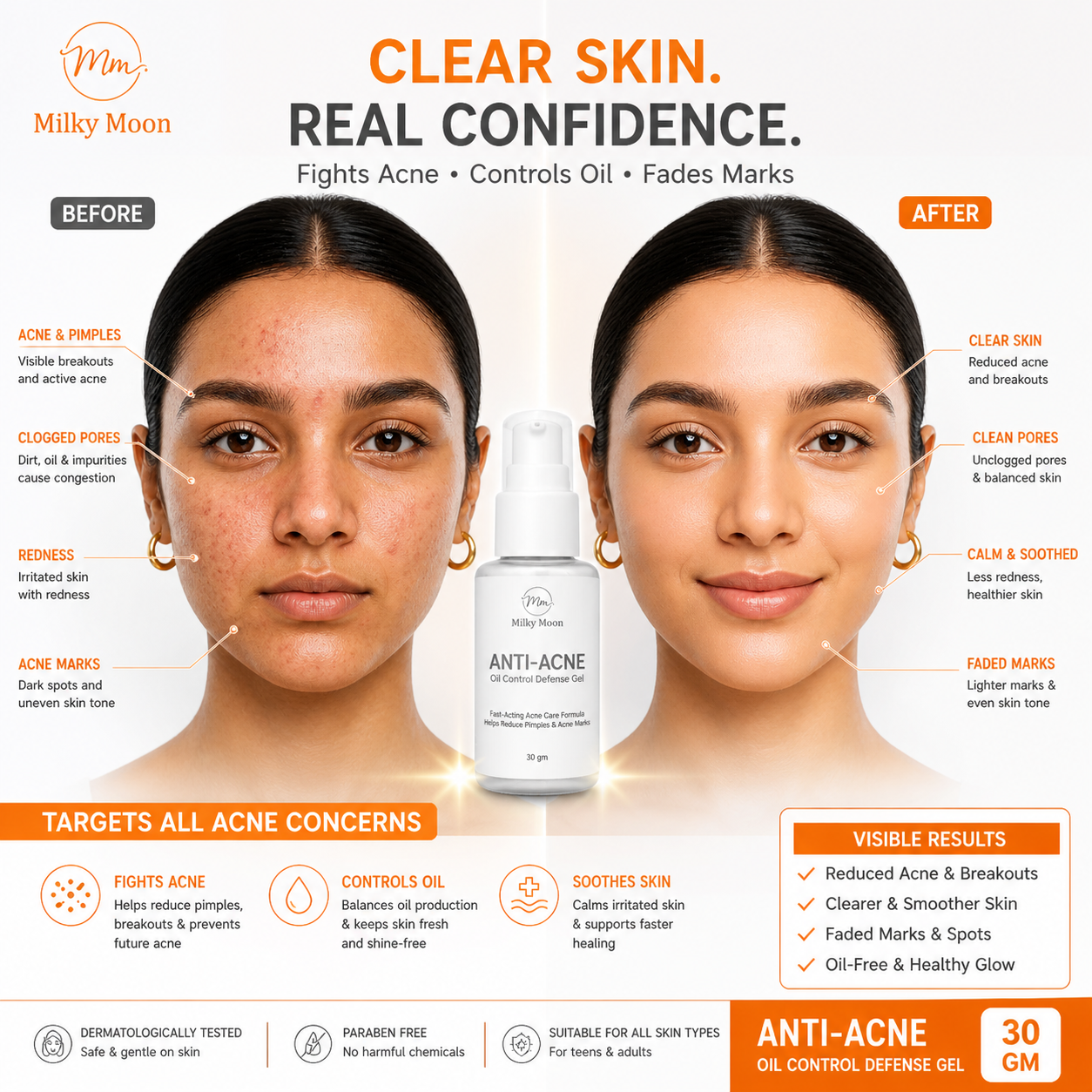 Anti-Acne Oil Control Defense Gel, Fast-Acting Formula, Fades Acne Marks, All Skin Types, 30 gm